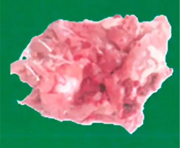 Frozen chicken leg meat skin on 2