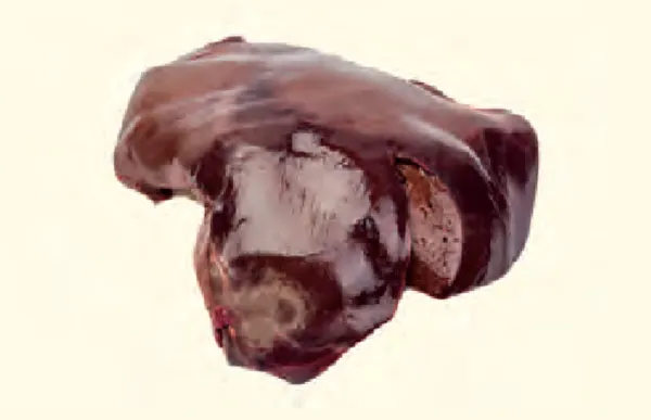 Liver
