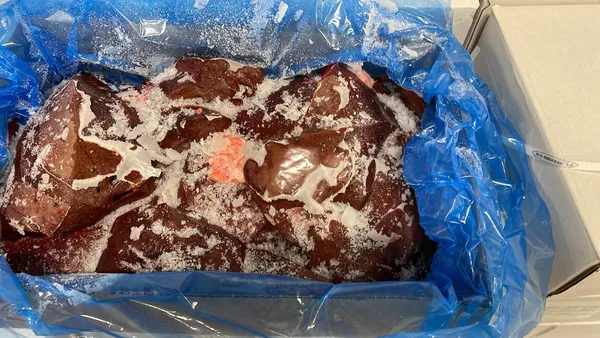 Frozen beef liver 2